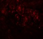 PIAS1 Antibody